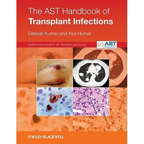 The Ast Handbook of Transplant Infections