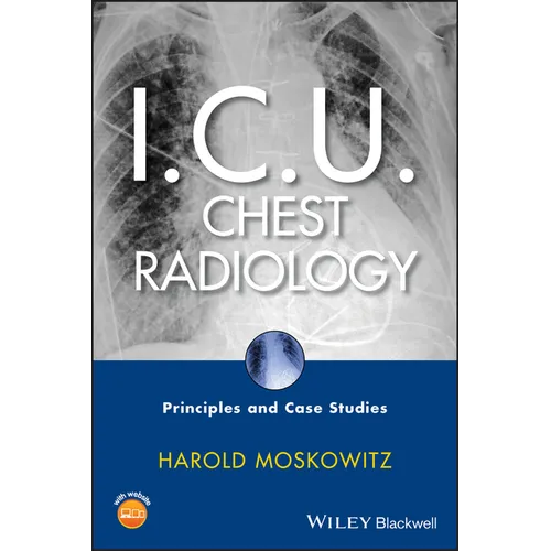 I.C.U. Chest Radiology: Principles and Case Studies [With CDROM]
