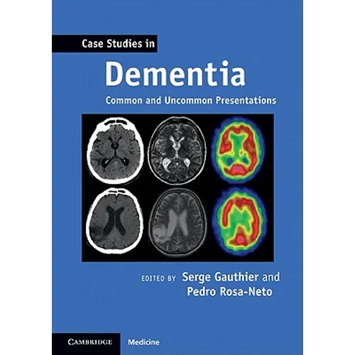 Case Studies in Dementia: Volume 1: Common and Uncommon Presentations