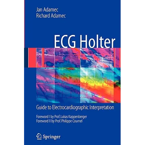 ECG Holter: Guide to Electrocardiographic Interpretation